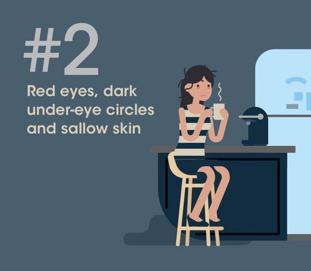 13423_sleepwell_livewell_red_eyes_dark_circle_and_sallow_skin_2_1